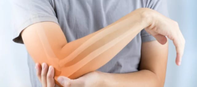 علاجات العظام