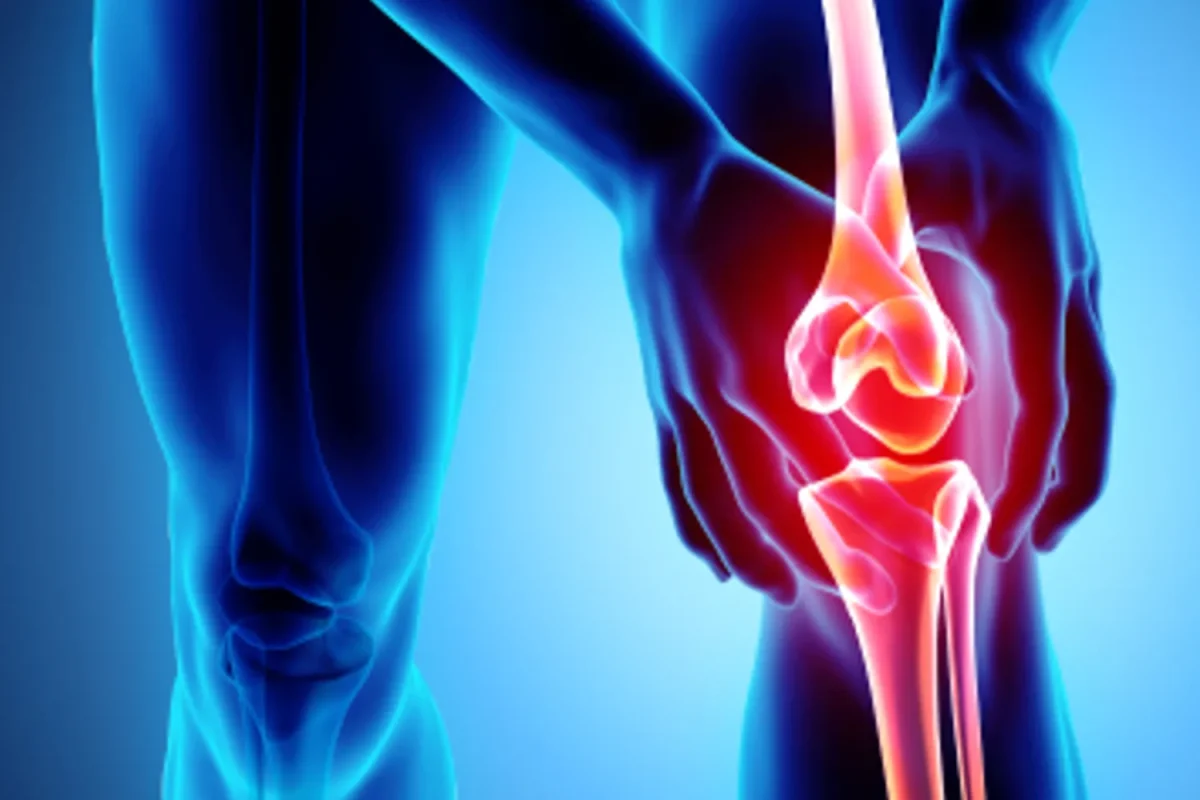 علاج خشونة الركبة