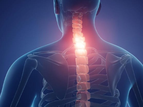 غضروف الرقبة