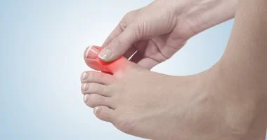 احدث علاج لمرض النقرس .. تعرف علي الجديد في علاج النقرس