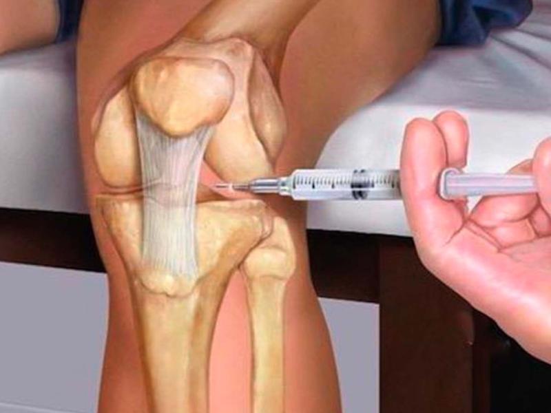 ما هو حقن الركبة بالزيت