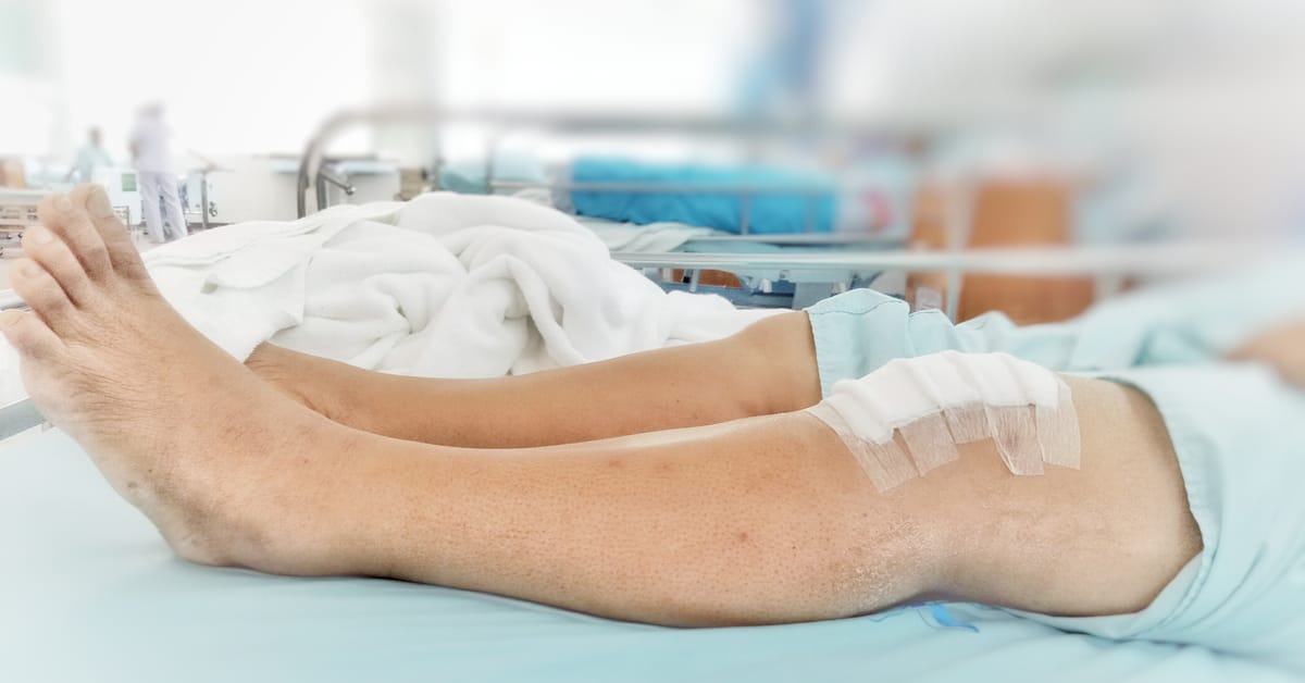 متى استطيع المشي بعد عملية غضروف الركبة؟