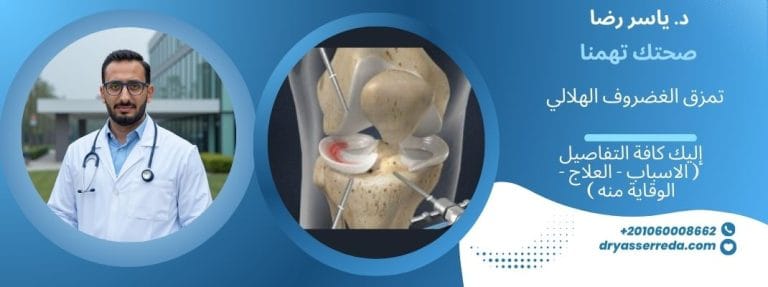 تمزق الغضروف الهلالي