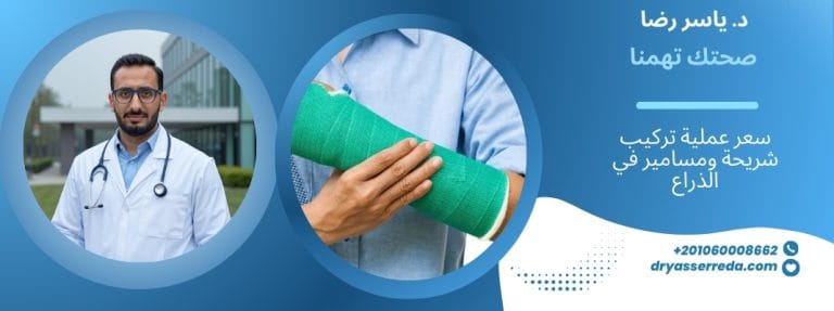 سعر عملية تركيب شريحة ومسامير في الذراع