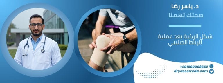 شكل الركبة بعد عملية الرباط الصليبي