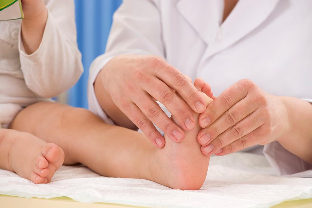 طرق تشخيص تسطح القدم عند الأطفال