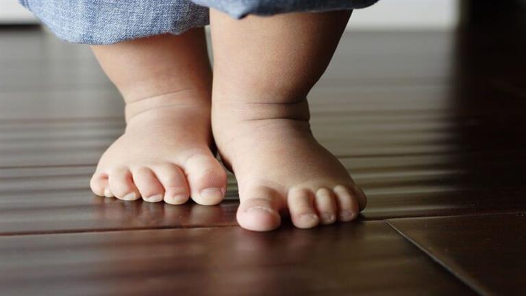الأعراض الشائعة والمبكرة لمرض لين العظام عند الأطفال