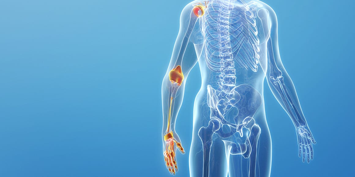 أورام العظام الحميدة