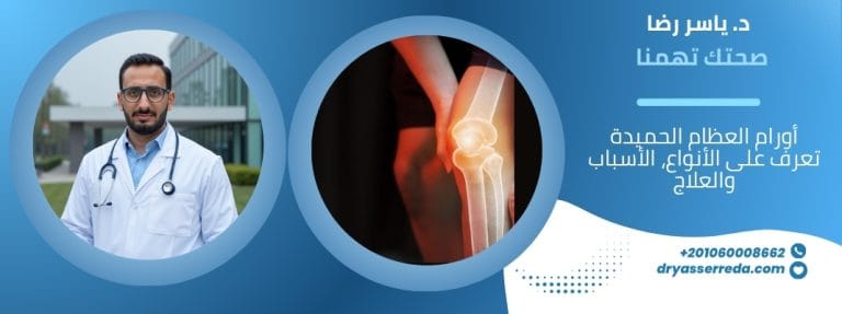 أورام العظام الحميدة