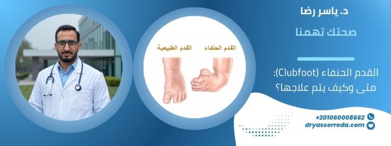 القدم الحنفاء