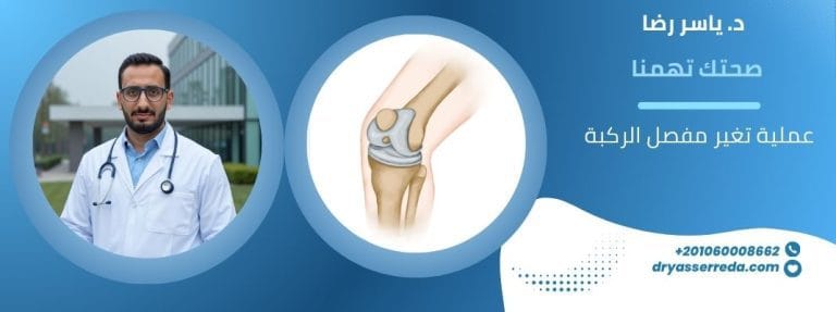 عملية تغير مفصل الركبة