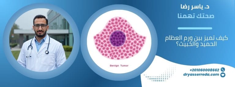 كيف تميز بين ورم العظام الحميد والخبيث؟