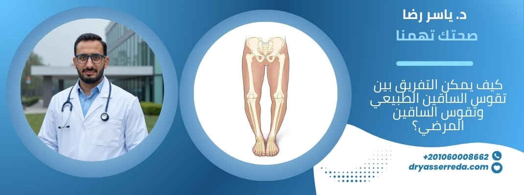 كيف يمكن التفريق بين تقوس الساقين الطبيعي وتقوس الساقين المرضي