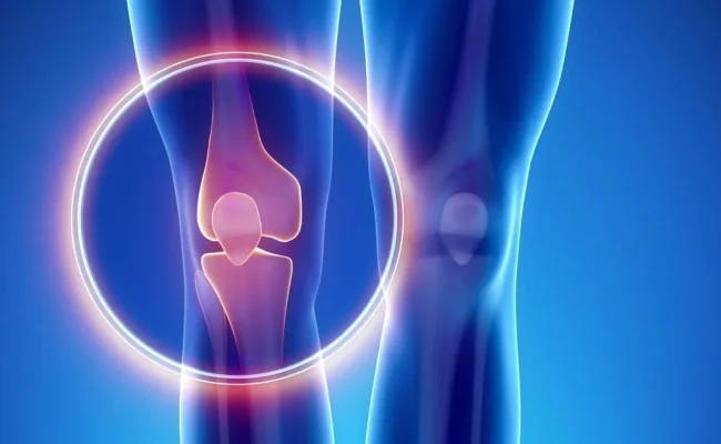 ما هو ألم العظام؟