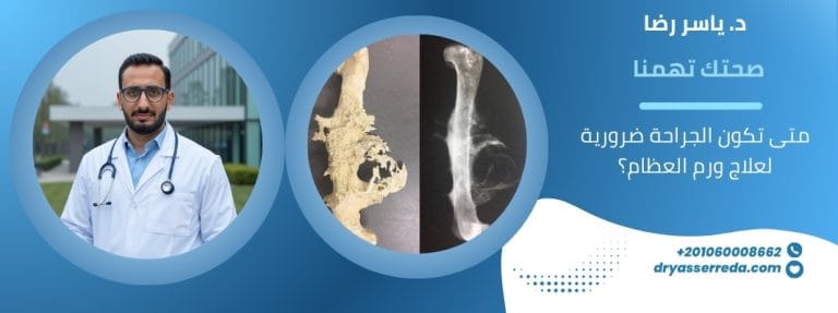 متى تكون الجراحة ضرورية لعلاج ورم العظام؟