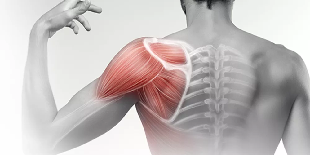 علاج قطع الأوتار الدوارة بالكتف