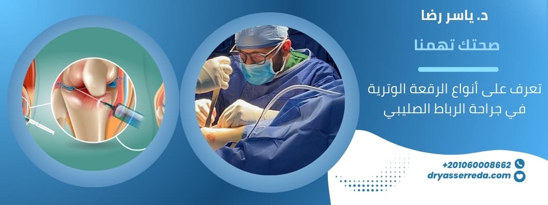 أنواع الرقعة الوترية في جراحة الرباط الصليبي