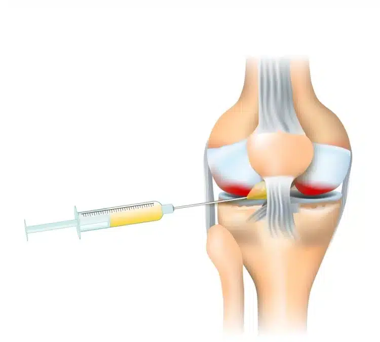كيف يتم التحضير للحقن؟
