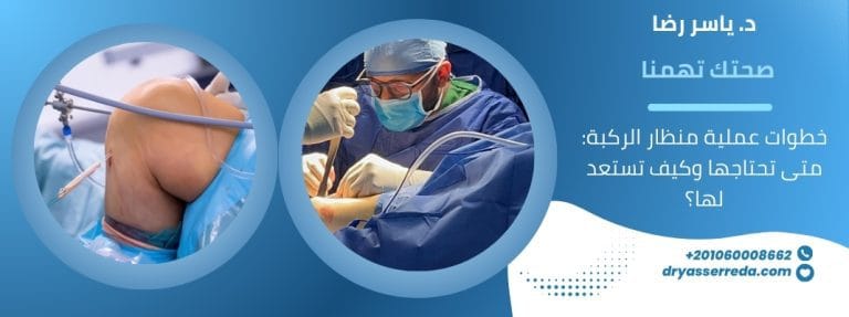 خطوات عملية منظار الركبة