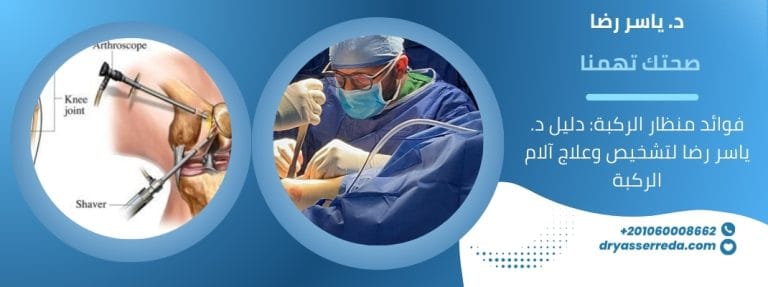 فوائد منظار الركبة