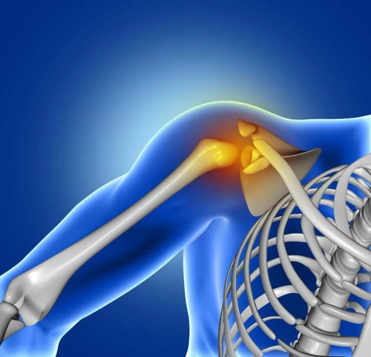 متي استطيع العودة الي العمل بعد عملية إصلاح أوتار الكتف