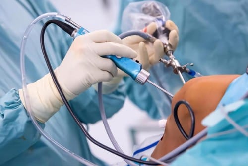 تكلفة عملية الرباط الصليبي بالمنظار