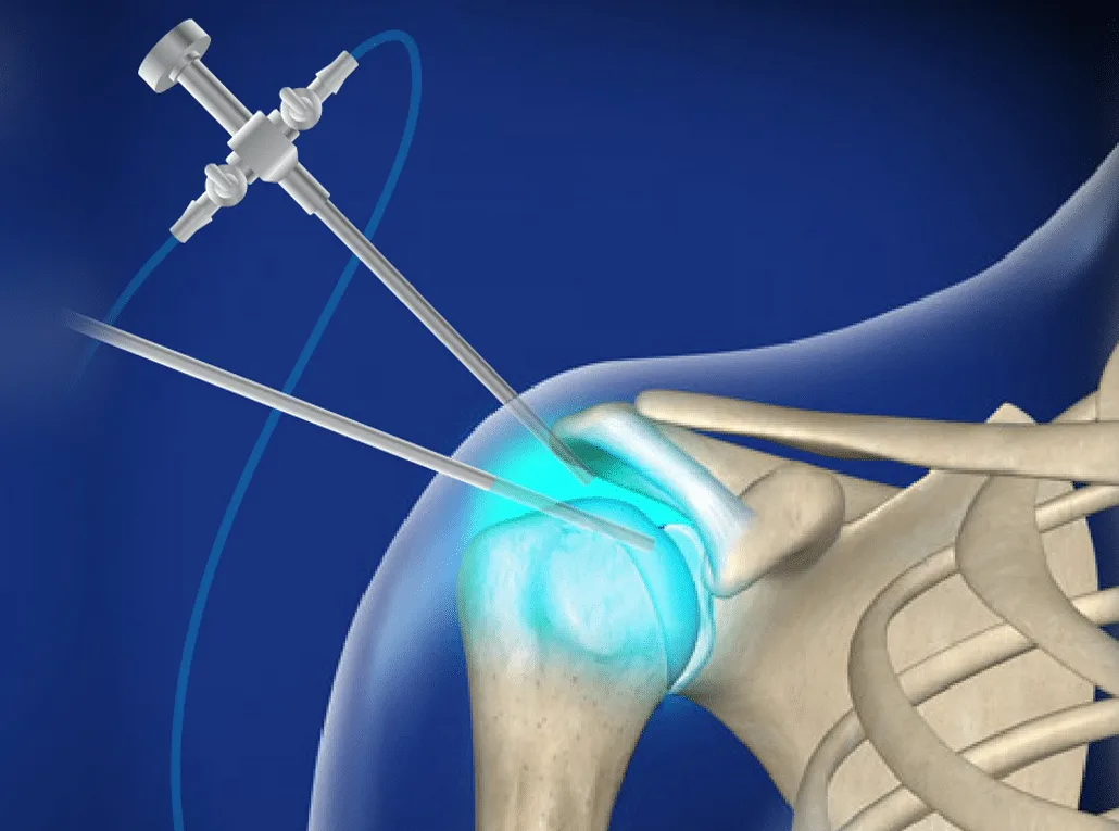أفضل دكتور عظام تابع لتأمين Med Net