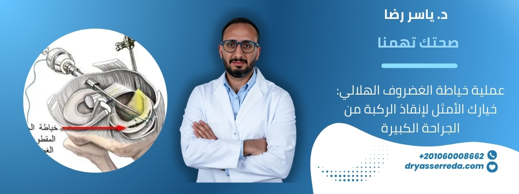 علاج قطع الغضروف الهلالي