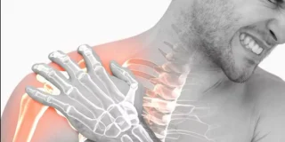 عملية الكتف المتجمد