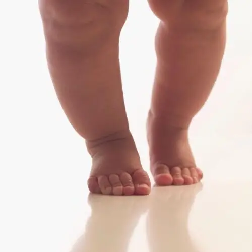 تصليح إعوجاج وتقوس الساق
