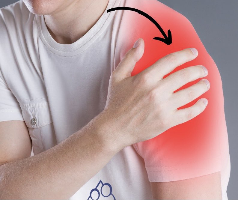 أفضل مرهم لعلاج التهاب أوتار الكتف