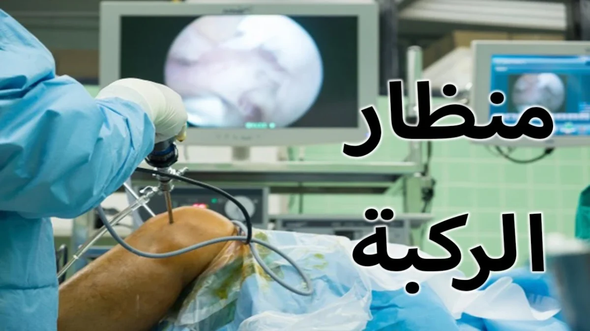 أفضل دكتور منظار ركبة في مصر