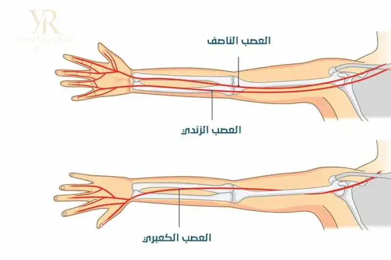 عملية تحرير العصب الزندي
