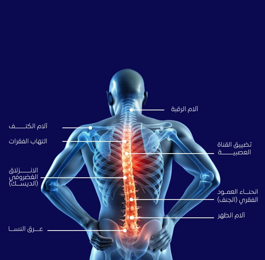 عملية توسيع القناة العصبية