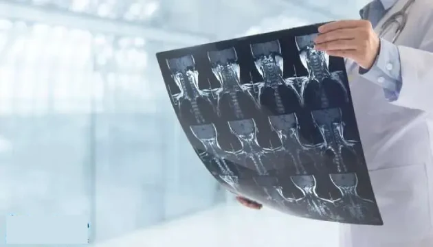 افضل دكتور عظام تابع لتأمين الاهلي للخدمات الطبية